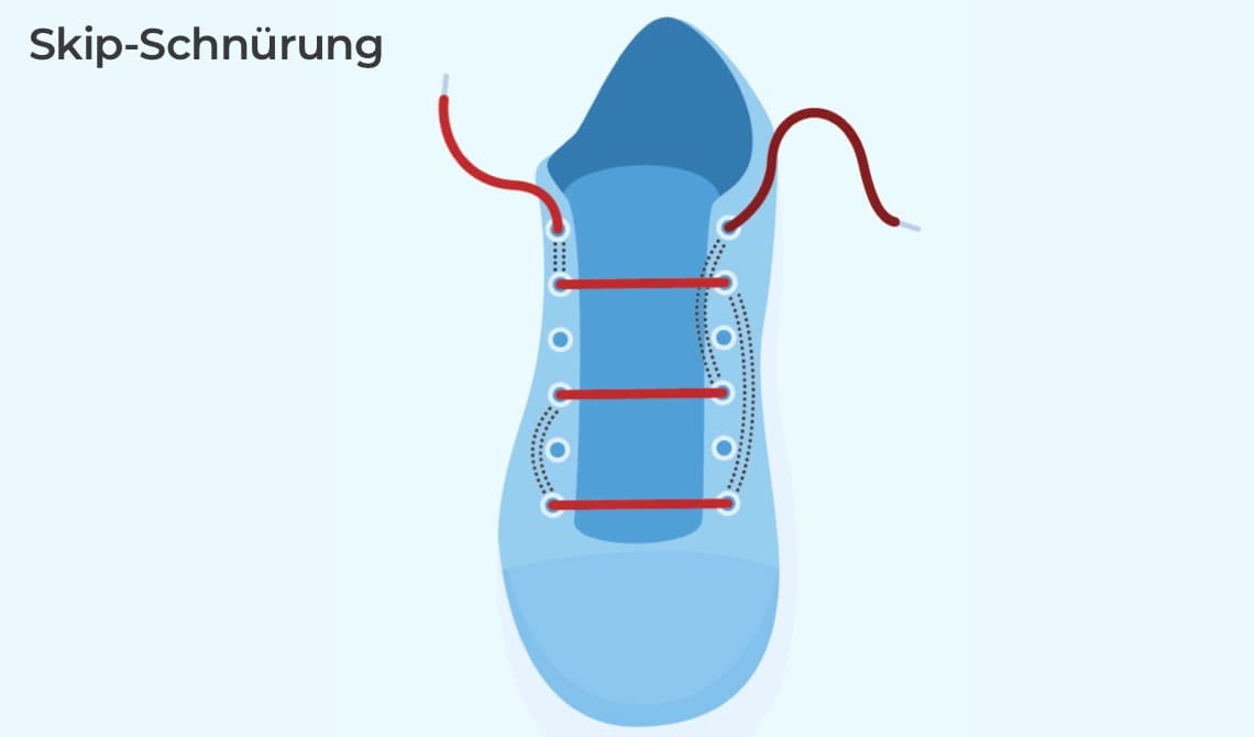 Skip-Schnürung
