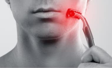 Rasurbrand im Intimbereich vermeiden