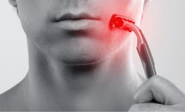 Rasurbrand im Intimbereich vermeiden