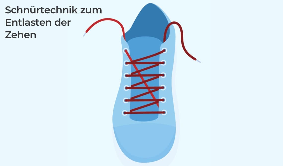 Schnürtechnik zum Entlasten der Zehen